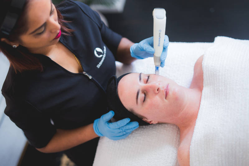 Dermapen 4 Acne Facial Auckland